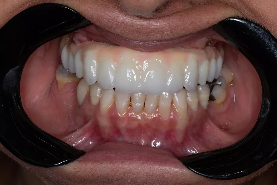 img-8146-1-69602ed04a55a